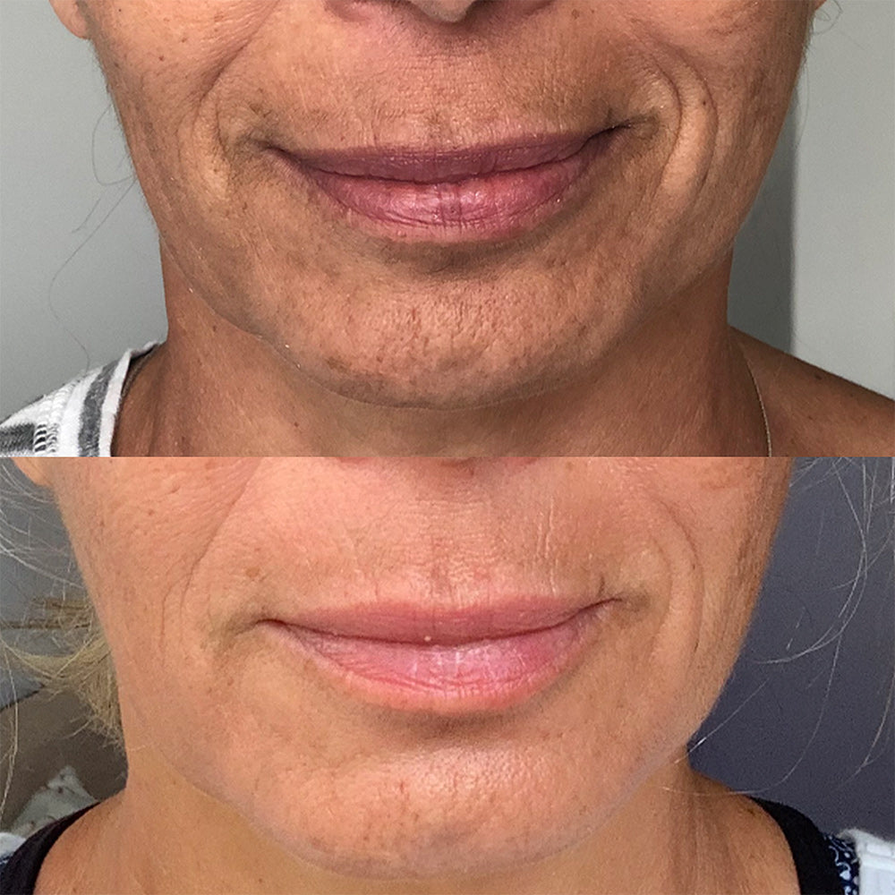 Vanessa-Megan_100_-Natural_Rapid-Dermal-Repair-Skin-Recovery-Kit