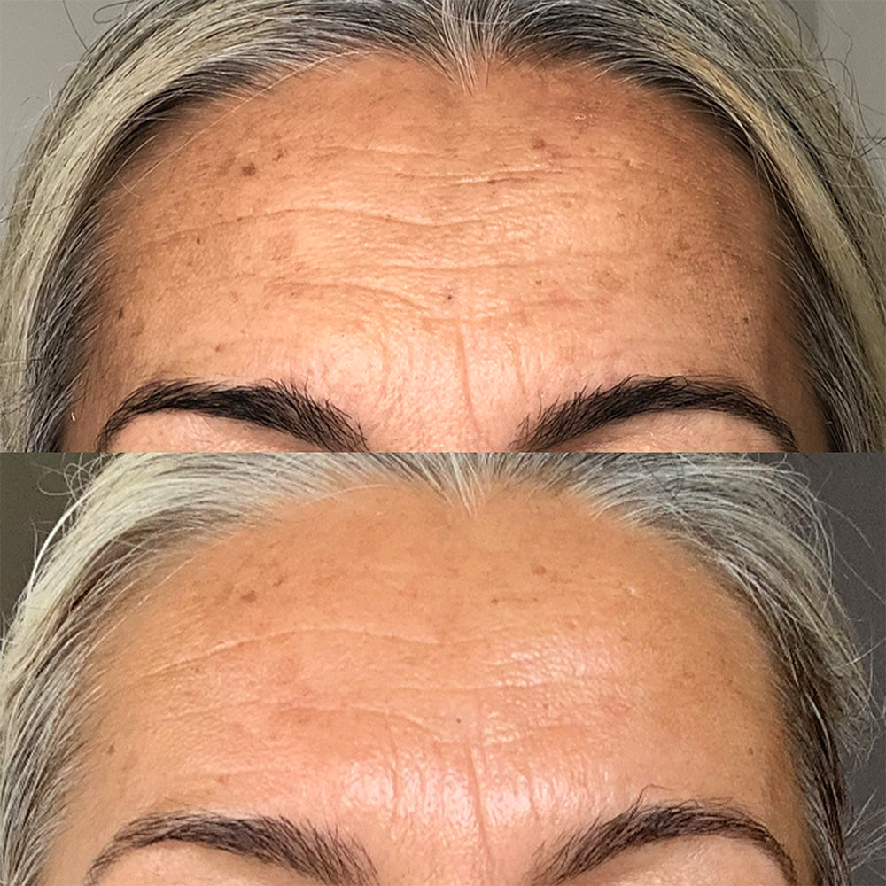 Vanessa-Megan_100_-Natural_Rapid-Dermal-Repair-Skin-Recovery-Kit
