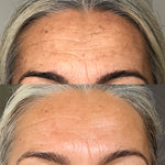 Vanessa-Megan_100_-Natural_Rapid-Dermal-Repair-Skin-Recovery-Kit
