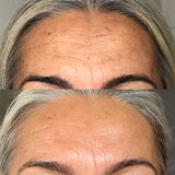 Vanessa-Megan_100_-Natural_Rapid-Dermal-Repair-Skin-Recovery-Kit