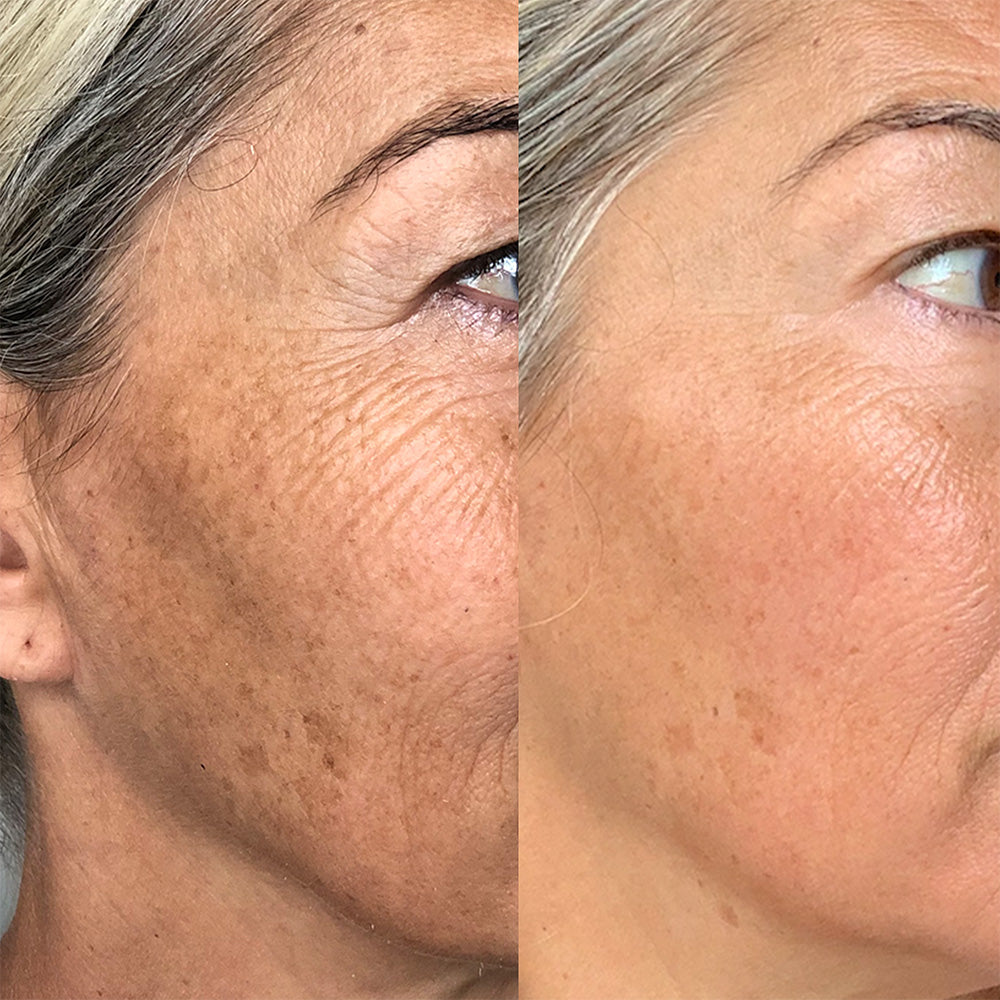 Vanessa-Megan_100_-Natural_Rapid-Dermal-Repair-Skin-Recovery-Kit