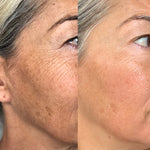 Vanessa-Megan_100_-Natural_Rapid-Dermal-Repair-Skin-Recovery-Kit