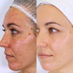 VanessaMeganNaturaceuticalSkincare_Results_Jody_Pigmentation