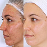 VanessaMeganNaturaceuticalSkincare_Results_Jody_Pigmentation